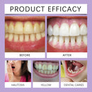 Oralhoe Mint Purple Gum Care Gel Pen Deep Cleaning Nourishing Strengthening Relief Discomfort Non-irritating Gum Health Care Gel