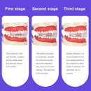 AZDENT Soft and Hard Tooth Orthodontic Appliance Aligners Trays Teeth Straightener High-tech Dental Transparent Teeth Retainer