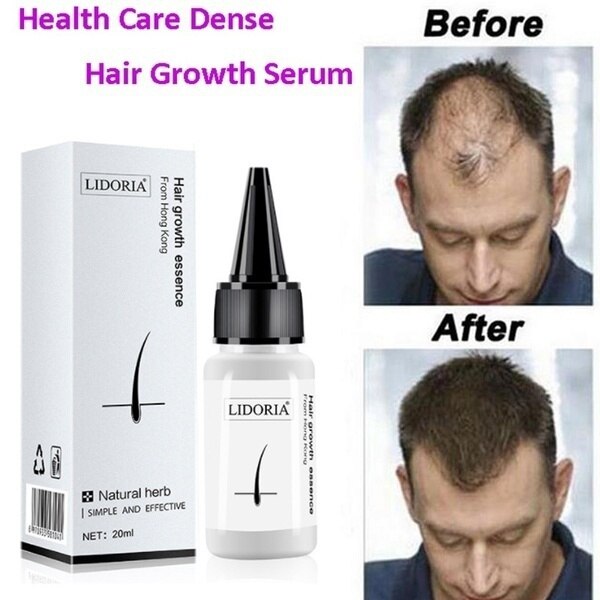 For Men Fast Hair Growth Essence Oil Hair Loss Treatment Help For Hair Growth Serum Repair Shampoo Lador Repair Treatment Dense