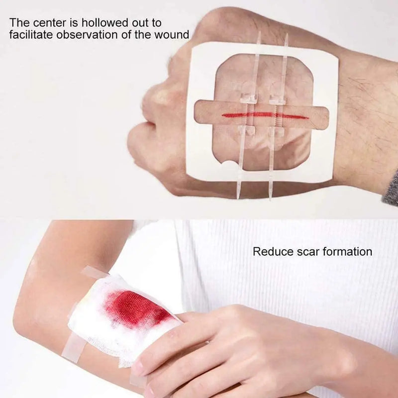 2pcs Adhesive Zipper Bandage Wound Closure Emergency Laceration Strips Without Suture for Survival Kit First Aid kit Trauma Care