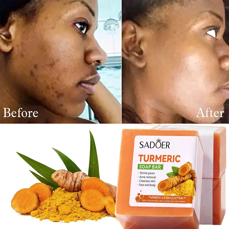 Kojic Acid Dark Spot Remove Soap for Cleaning the Face Oil Control Even Tone Skin Products Natural Turmeric Soap Bar New