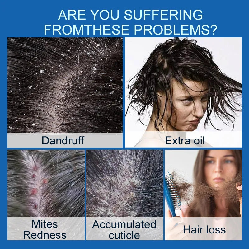 PURC Hair Scalp Treatment Hair Oil Dandruff Itching Anti Loss Oil Control Smoothing Essence Spray Hair Care Beauty Health 60ML