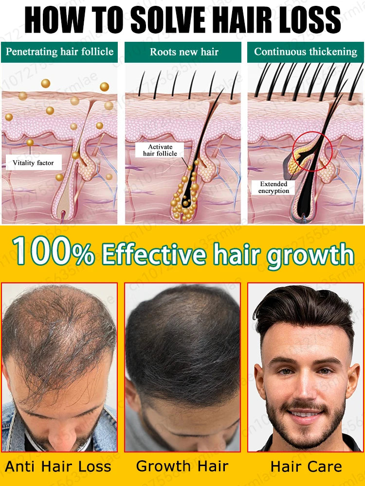 Hair growth essential oil. Effectively repair baldness and hair loss symptoms