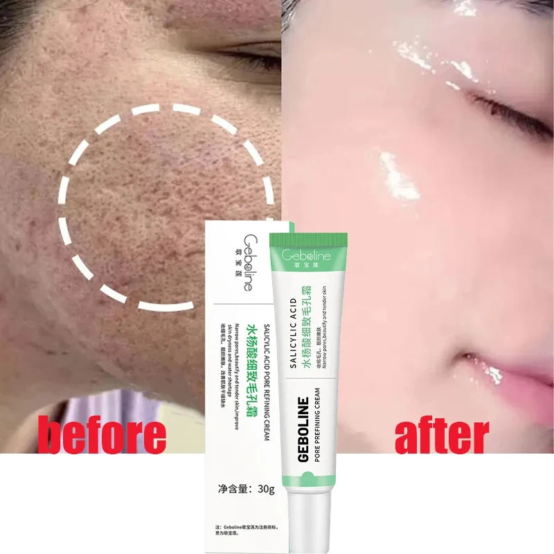 New Salicylic Acid Pore Shrinking Face Cream Reduces Pores Brightens Tightens Face Smoothes Hydrating Moisturizing Korea Skin