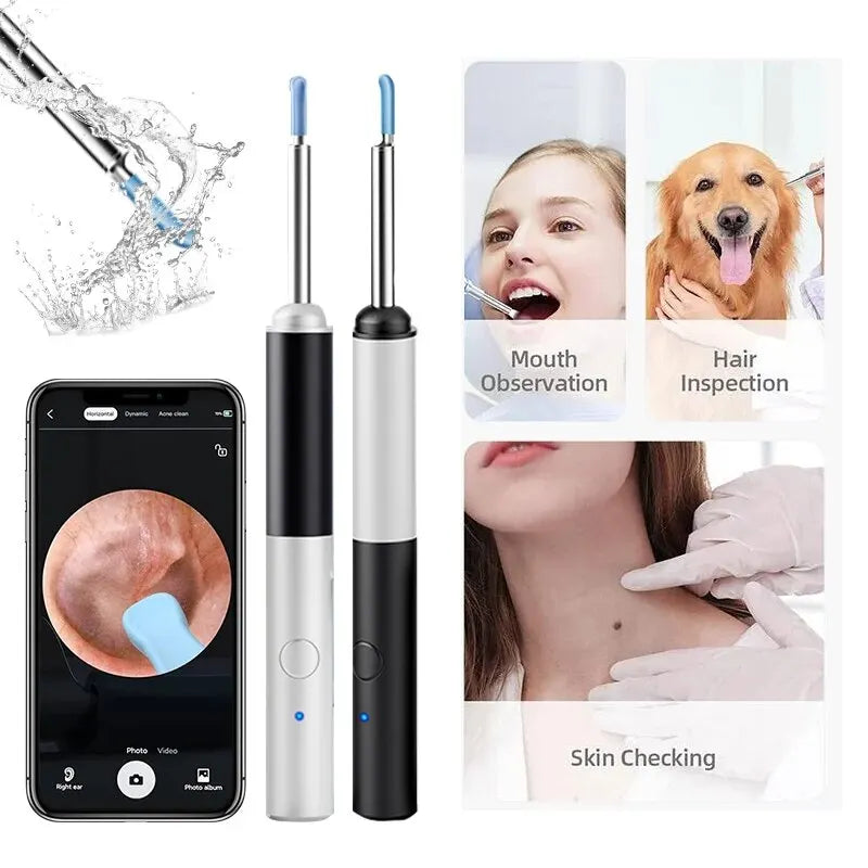 Wireless Otoscope 3.9mm Ultra-Thin WiFi Ear Scope Camera with Earwax Removal Tool Ear Cleaner with Gyroscope For IOS Android