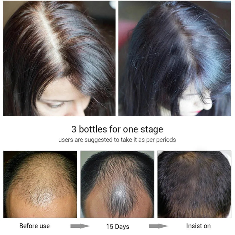 Biotin Fast Hair Growth Shampoo  Anti Hair Loss Serum Scalp Treatment Prevent Alopecia Baldness Conditioner Hair Care Hair Mask