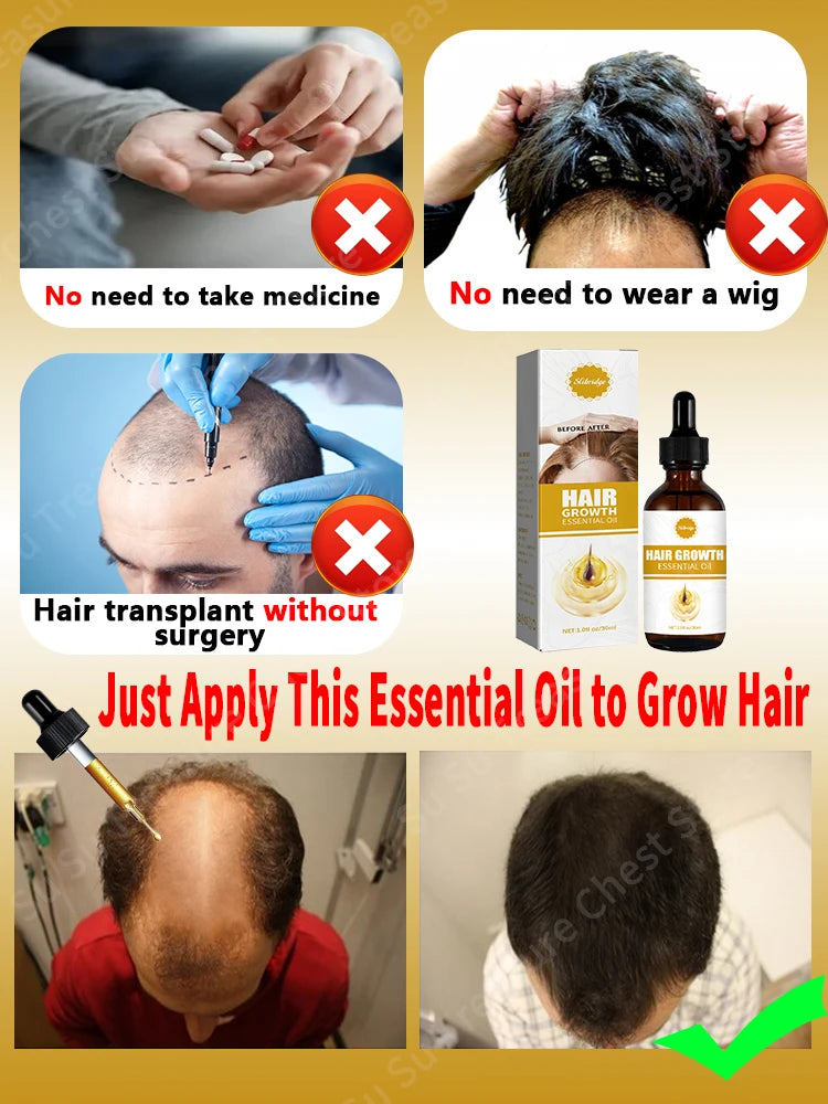 Fast Hair Growth Oil For men treatment