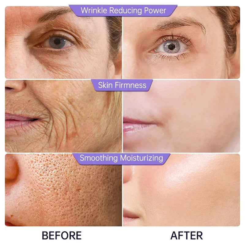 Collagen Face Serum Wrinkle Removal Anti Aging Hyaluronic Acid Forehead Fine Lines Lifting Facial Serum Skin Care Beauty