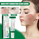 Dark Spot Correcting Glow Serum Fade Pigment Freckle Melasma Melanin Improves Dull Skin Facial Whitening Brightening Essence
