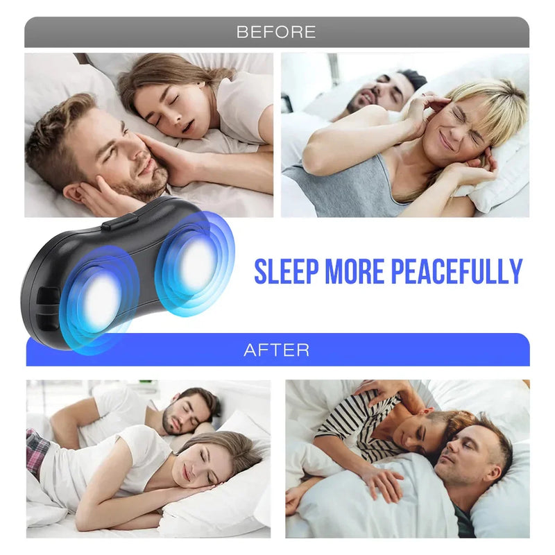 Electric Smart Anti Snoring Device EMS Pulse Stop Snore Portable Comfortable Sleep Well Snoring Stop Sleep Apnea Aid USB