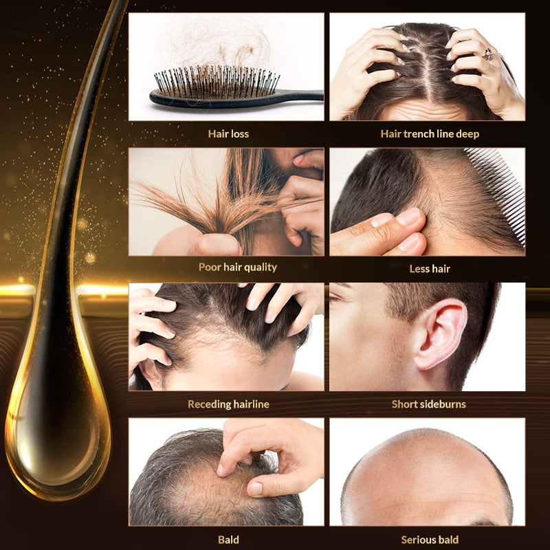 OMY LADY Haarwachstumsspray Anti-Haarausfall Essenziell Schnelles Nachwachsen Verhindert Haarschäden Ausdünnung Reparaturpflege Kopfhautbehandlung 60ml
