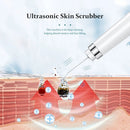 Depurador ultrasónico de la piel, limpieza Facial eléctrica, limpiador profundo de poros, eliminador de espinillas y acné, dispositivo de pala para pelar, máquina de belleza