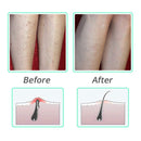 Exfoliating Shower Brush Hair Massage Comb Scalp Massager Ingrown Hair and Razor Bump Treatment Body Scrub Tool for Man & Woman