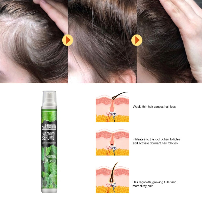 Effektives Haarwachstums-Serum-Spray, schnell, dick, für Haare, verhindert Haarausfall, beschädigtes Haar, repariert natürliche Haarpflegeprodukte TSLM1