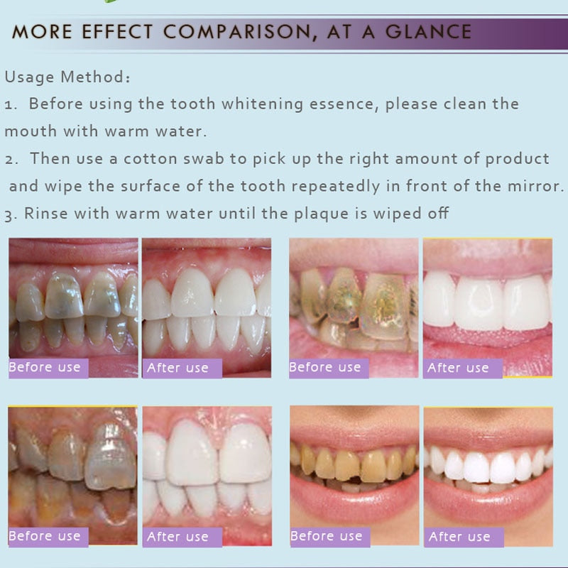Esencia para blanqueamiento de dientes, tratamiento de manchas de dientes amarillos, placa de café con humo, higiene bucal Dental, elimina el cuidado de los dientes blanqueadores