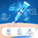 Sumifun, 20g, crema para eliminar cicatrices de acné, reparación de cicatrices viejas, crema para reparar quemaduras, crema suavizante para el cuerpo y la cara, crema hidratante para la piel a base de hierbas