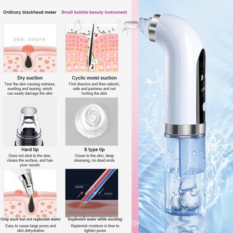Removedor de espinillas eléctrico de burbujas pequeñas, ciclo de agua recargable por USB, herramienta de limpieza Facial de succión al vacío para eliminación de espinillas y acné