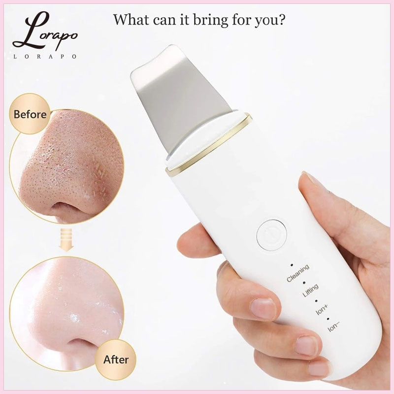 Facial Cleansing Ultrasonic Skin Scrubber Deep Cleansing Facial Cavitation Peeling Cleansing Scraper to Remove Keratin Skin Care