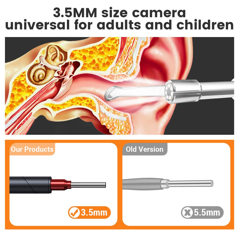 Endoscopio de oído Wifi, otoscopio de vídeo inalámbrico, otoscopio médico Digital para tableta IOS Android, cámara de 3,5mm, boroscopio de 1080*720