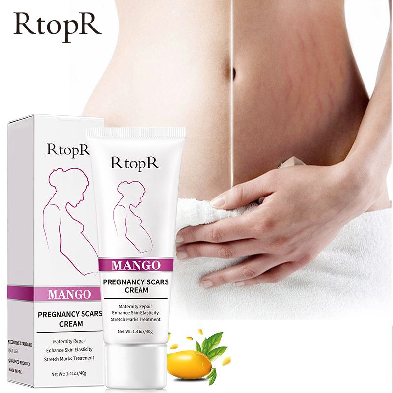 5pcs RtopR Mango Improves Skin Reduces Wrinkles Remove Skin Scars Treatments Pregnant Women Skin Cream Increases Skin Elasticity